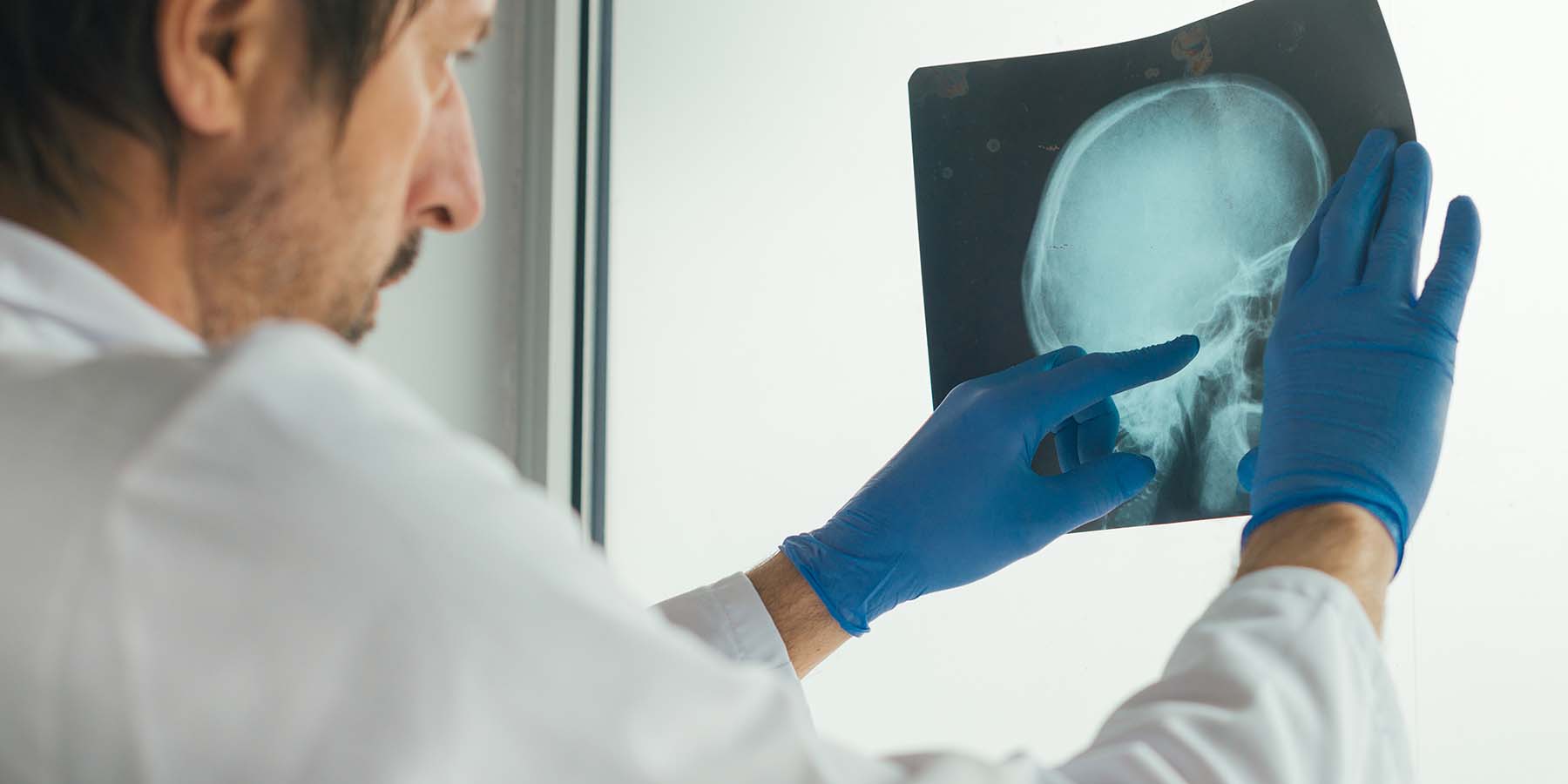 Consultant examining X-ray image of patient's skull